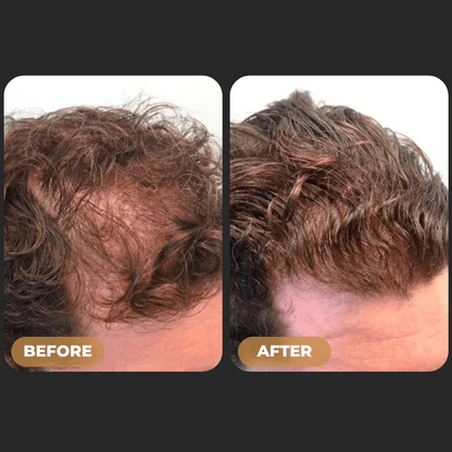 SPARTAN™Root Activator Conditioner