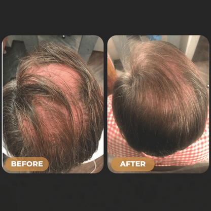 SPARTAN™ Root Activator Shampoo For Men Hair Loss
