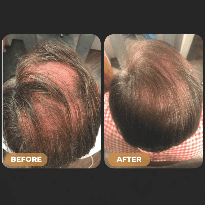 SPARTAN™Root Activator Conditioner